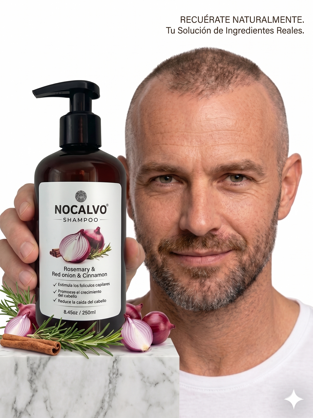 Champú NoCalvo – Poder de Cebolla (Formato Original)